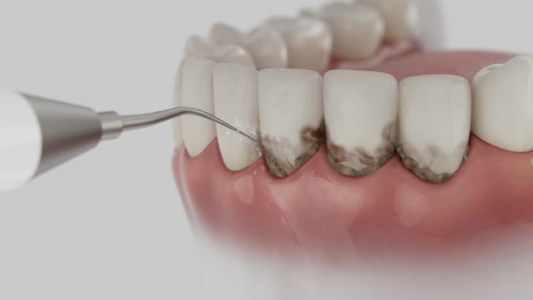 Trusted Teeth Cleaning And Checkup service in Byron, GA - Dentist Open Now